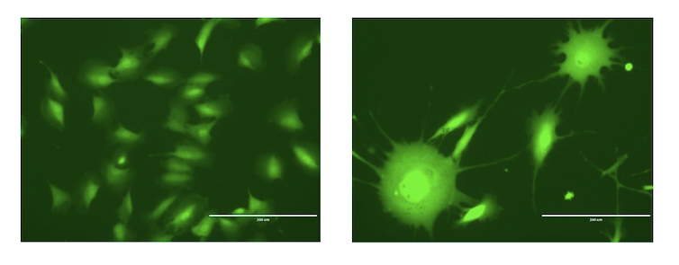 Microscopy images of ovarian epithelial cells before and after chronic arsenic exposure