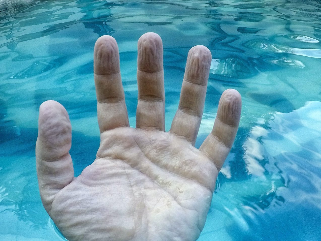 Why do fingers get wrinkly after a long bath or swim? A biomedical engineer explains