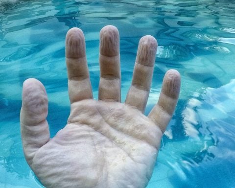 Why do fingers get wrinkly after a long bath or swim? A biomedical engineer explains