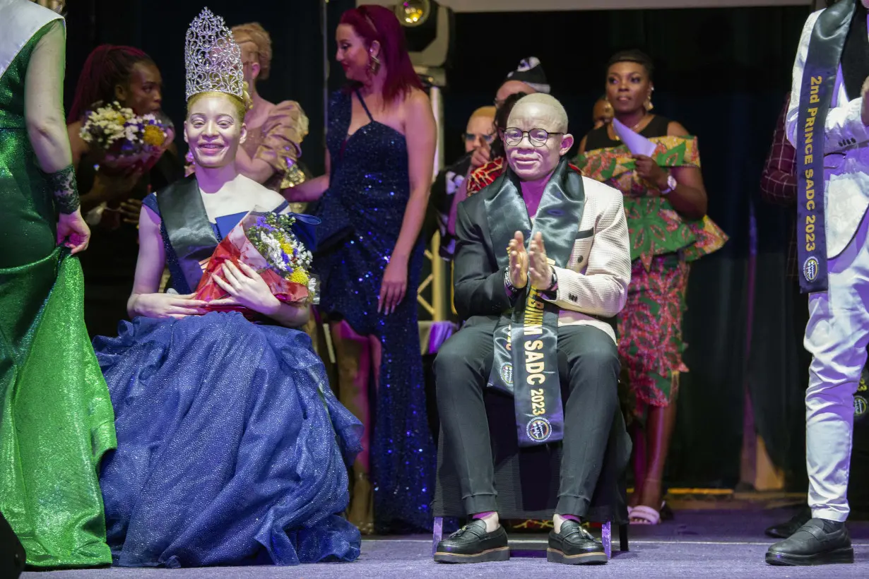 Winner of albinism pageant says Zimbabwe event made her feel beautiful and provided sense of purpose