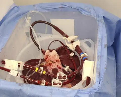 A first-ever experiment shows how pigs might one day help people who have liver failure