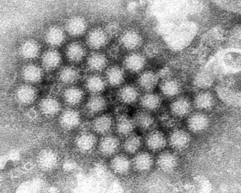 Norovirus illnesses are up in some places. Here's what you need to know