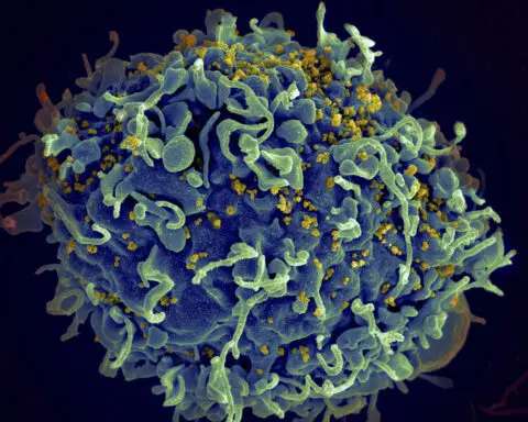 CDC says it's identified 1st documented cases of HIV transmitted through cosmetic needles