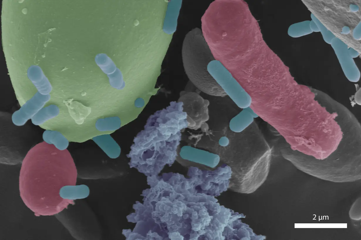 Sourdough under the microscope reveals microbes cultivated over generations