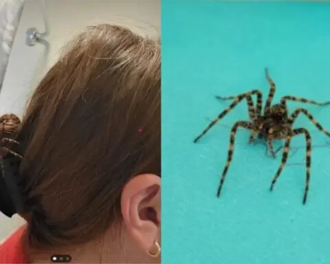 Woman returns from laundry trip with a creepy surprise in her hair