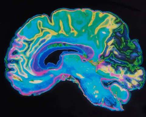 A detailed look at children’s brains might show how sex and gender are different, new study says