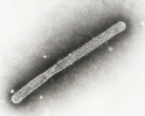 Two more bird flu cases reported in Colorado, but elsewhere a study finds no asymptomatic infections