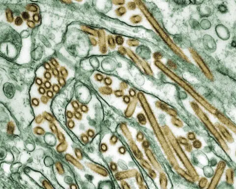 To prevent supercharged flu virus, CDC pushes seasonal flu vaccines to farmworkers at risk of coinfection with bird flu