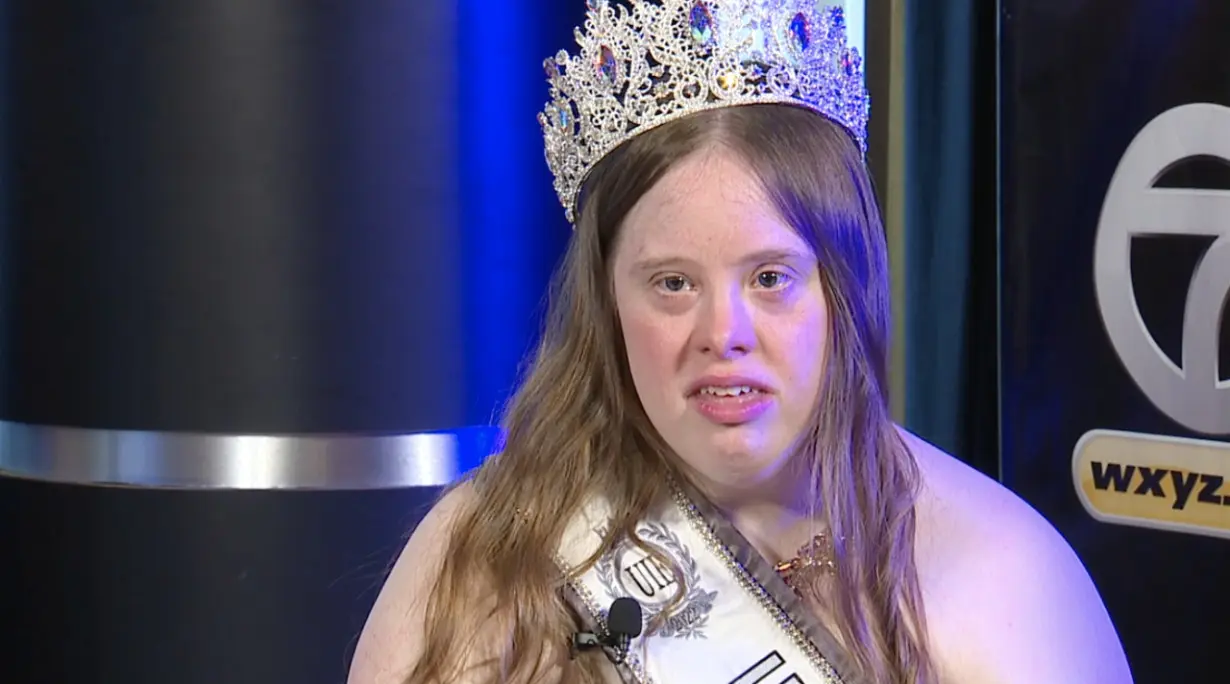 Amy has Down Syndrome, but that didn't stop her from showing immense courage competing in pageants alongside her mother.