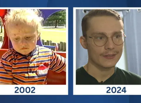 Man's rare liver disease conquered after 24-year battle