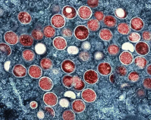 UN health agency convening experts to determine if the mpox outbreak in Africa is a global emergency