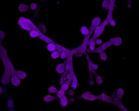 Mammary glands in a dish − what miniature organs reveal about evolution, lactation, regeneration and breast cancer