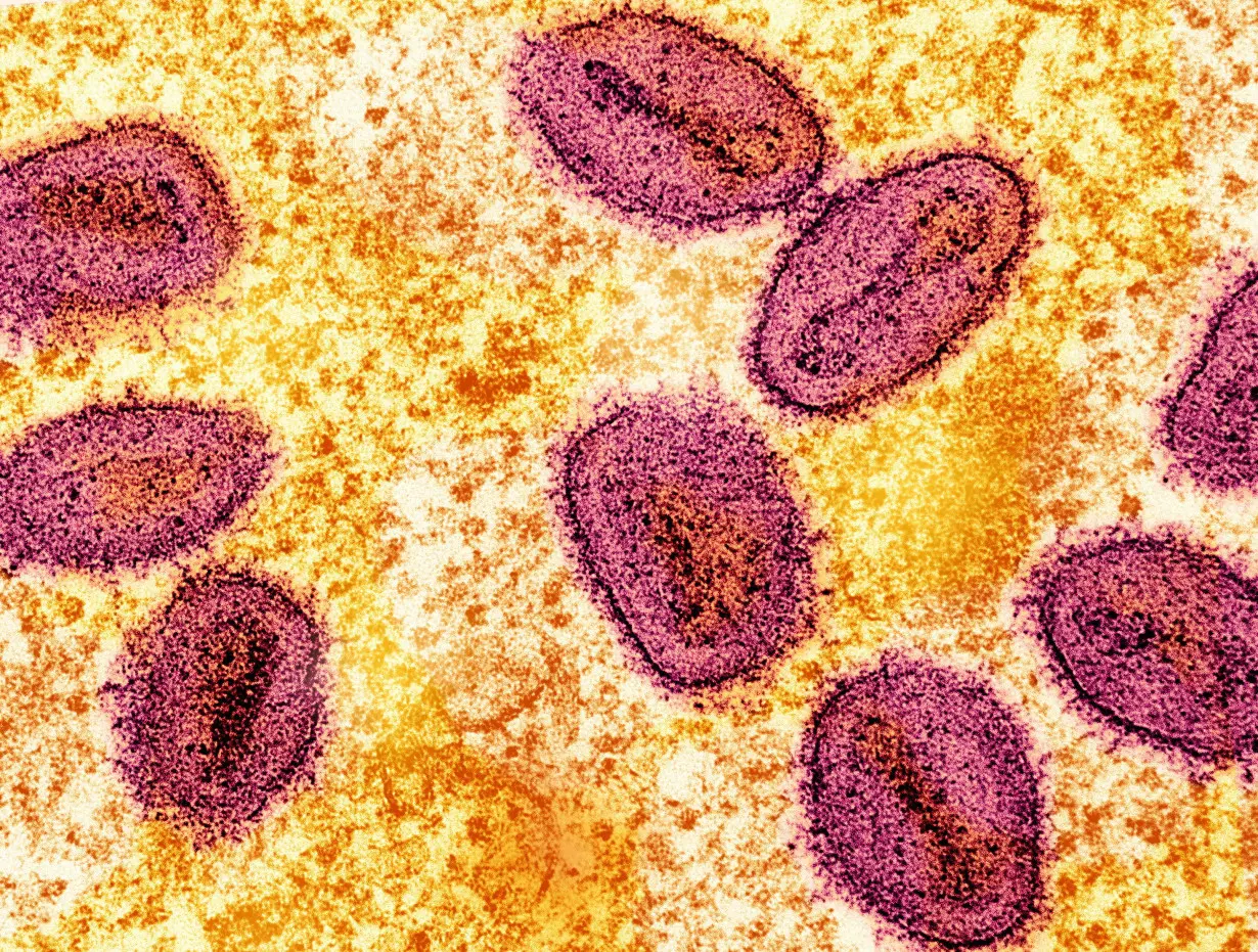 Colorized transmission electron micrograph of mpox virus particles captured at the NIAID Integrated Research Facility in Fort Detrick