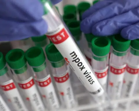 Philippines says recent mpox case is mild Clade 2 variant