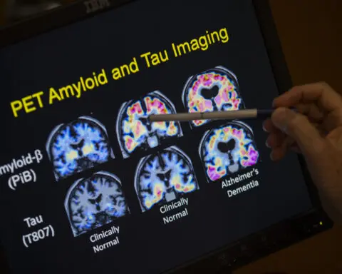 UK drug regulator approves Alzheimer's drug but government likely won't pay for it