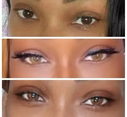 A quick surgical procedure can permanently change your eye color, but experts warn it’s not without risk