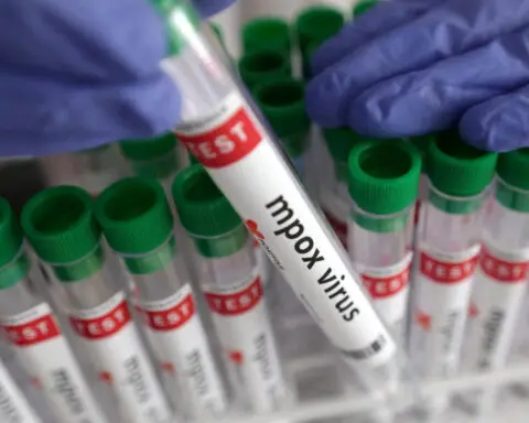 WHO boss calls for $135 million to stop mpox outbreak