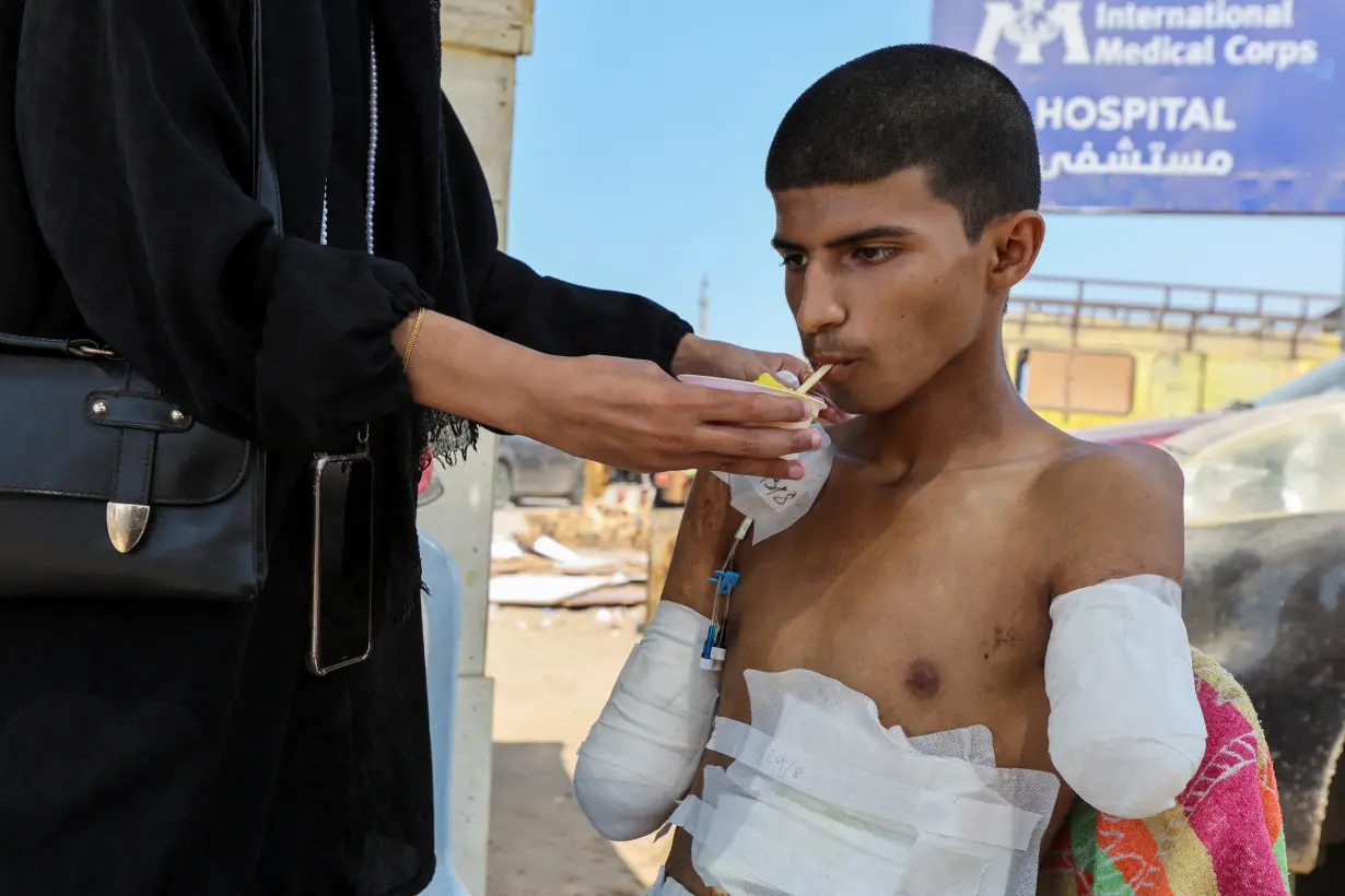 Gazan with amputated arms recounts the challenges he faces following his evacuation from Al-Aqsa hospital