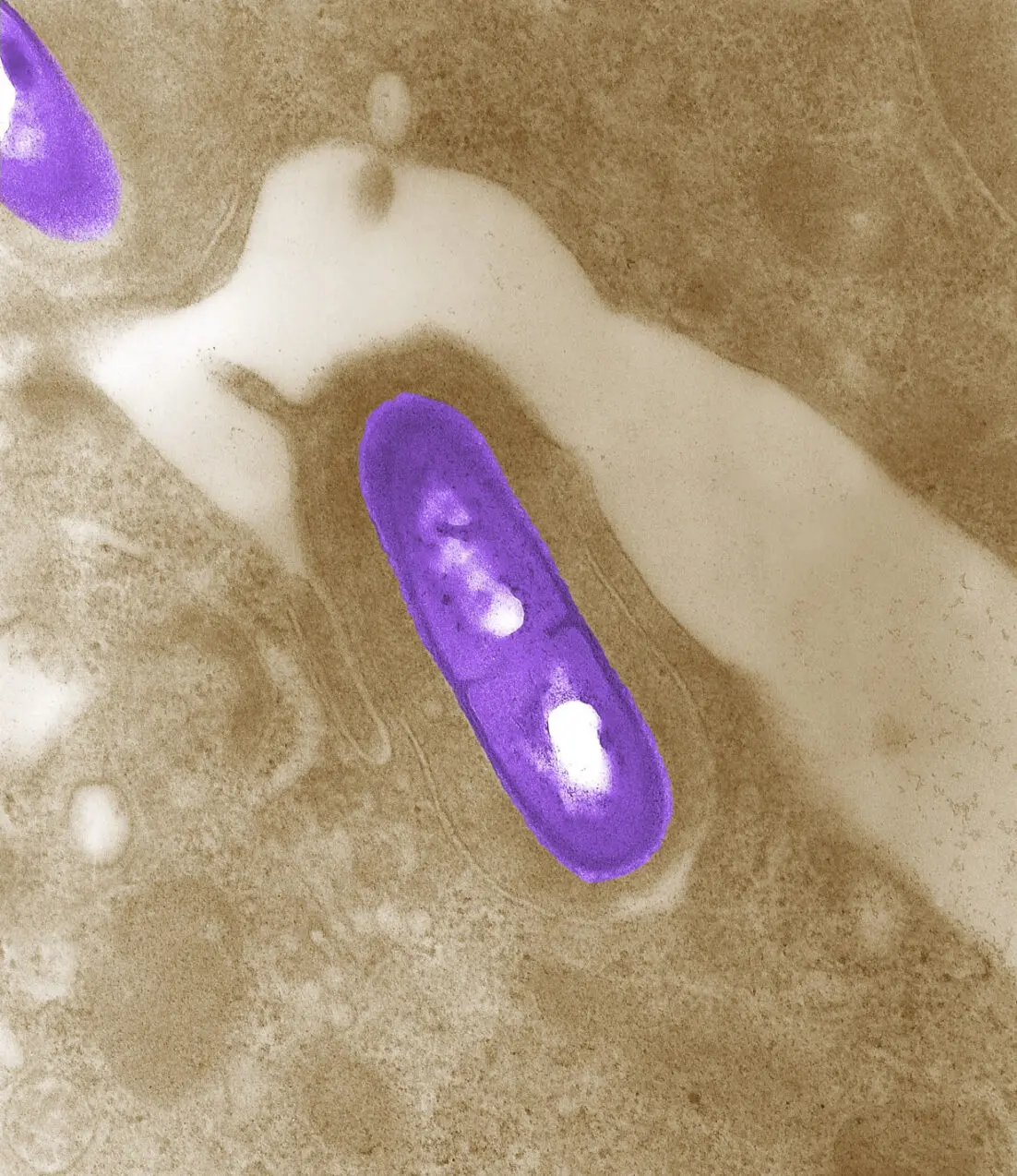 FILE PHOTO: An electron micrograph of a Listeria bacterium in tissue is seen in a 2002 image from the Centers for Disease Control and Prevention (CDC).