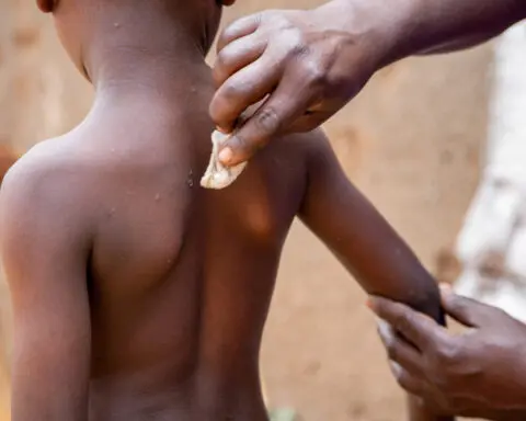 UNICEF issues emergency tender to secure mpox vaccines