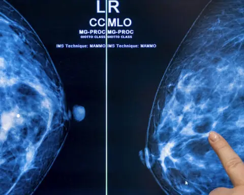 Breast density and mammograms: New FDA rule will ensure all women have more information after cancer screenings