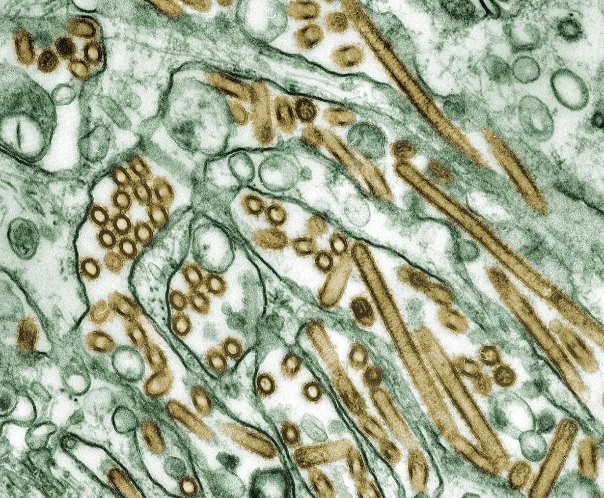 Mysterious bird flu case in Missouri was similar to strain circulating in cattle, CDC says