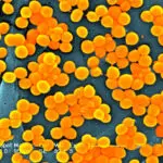 Nearly 40 million people could die from antibiotic-resistant superbug infections by 2050, new study estimates