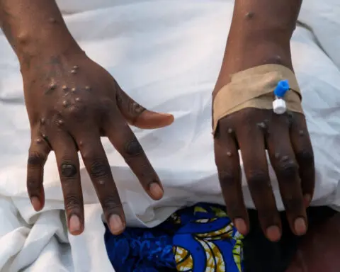 Almost 30,000 suspected mpox cases in Africa this year, WHO says