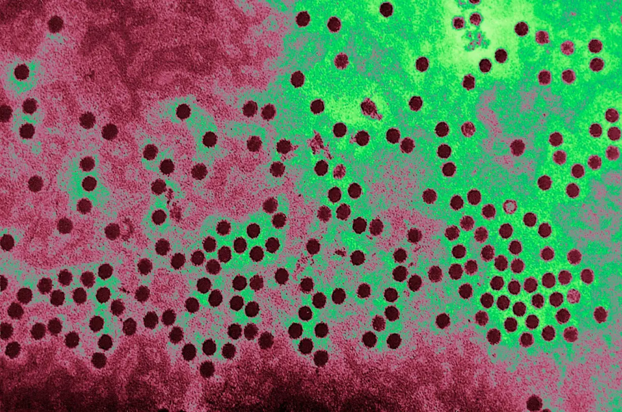 Common respiratory virus that dwindled during the pandemic is on the rise, CDC warns, with higher risk for certain groups