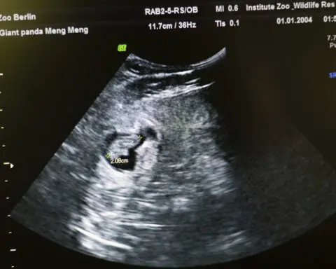 The Berlin Zoo is hoping for more German-born giant pandas as scans confirm a pregnancy