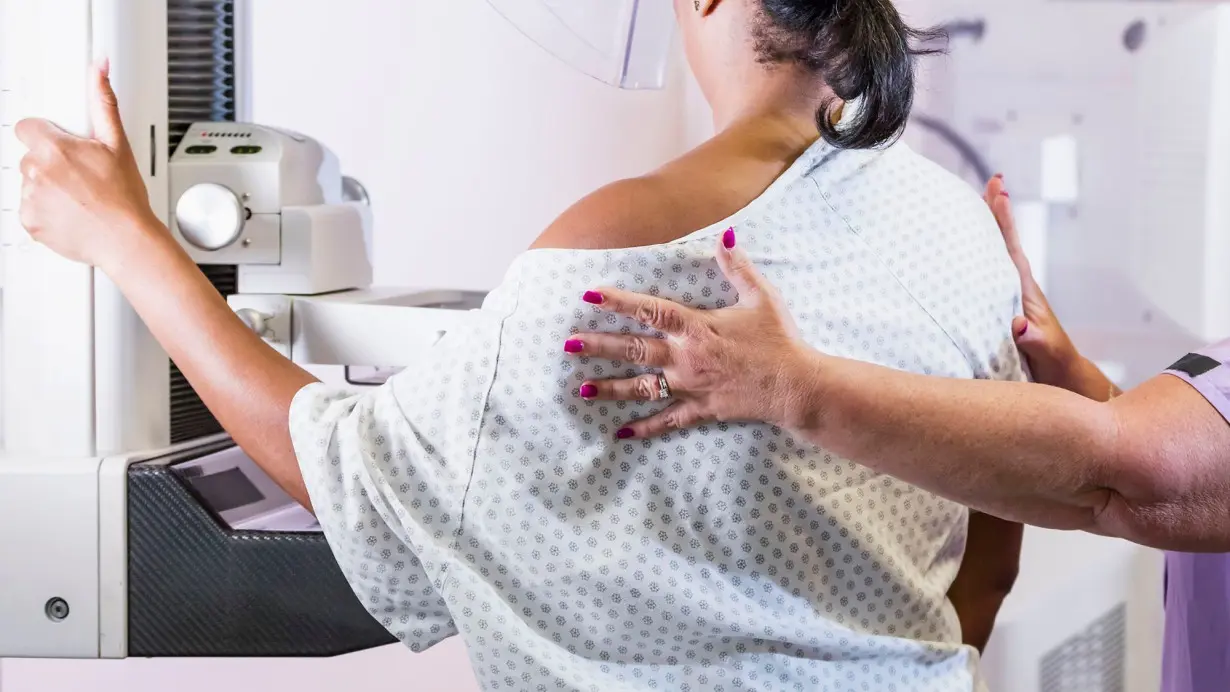 Breast cancer deaths in the US continue to fall, but new report warns of rise in cases among women younger than 50