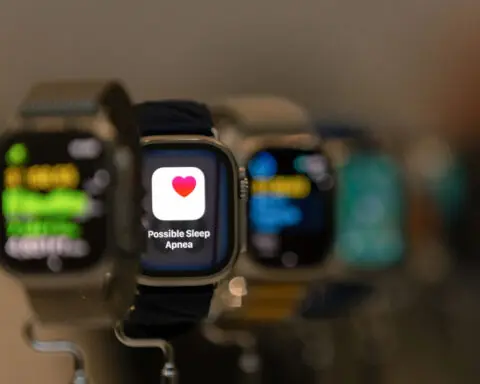 If your Apple Watch alerts you to sleep apnea, here’s what it means and what to do next