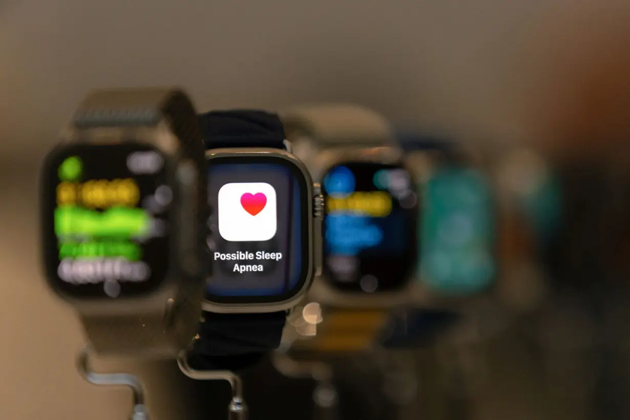 If your Apple Watch alerts you to sleep apnea, here's what it means and what to do next