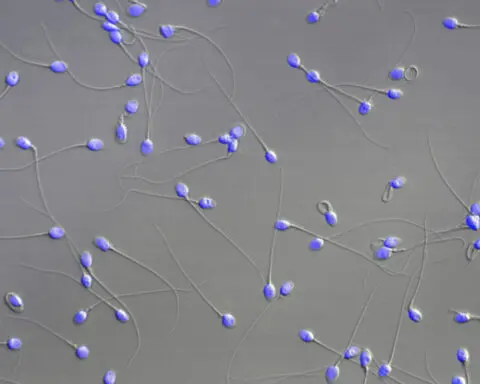 Scientists show how sperm and egg come together like a key in a lock