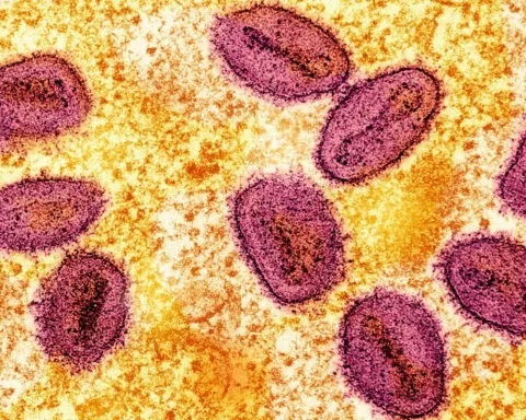 Britain identifies its first case of new mpox variant