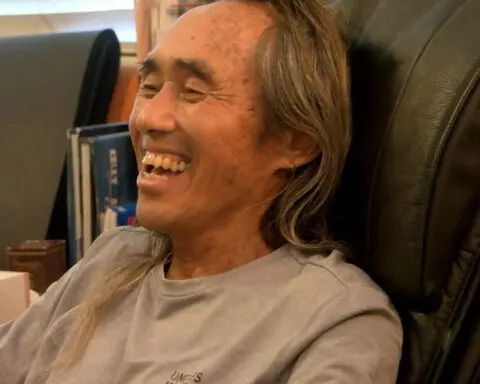 Despite losing a part of his leg to a shark bite, Maui surfer remains 'happy, grateful'