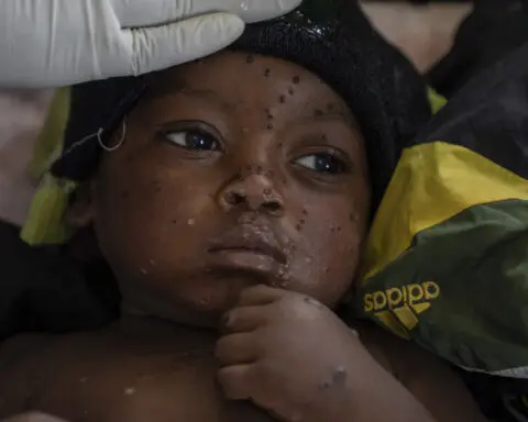 WHO says mpox cases in Congo's epicenter where the new variant was detected may be 'plateauing'