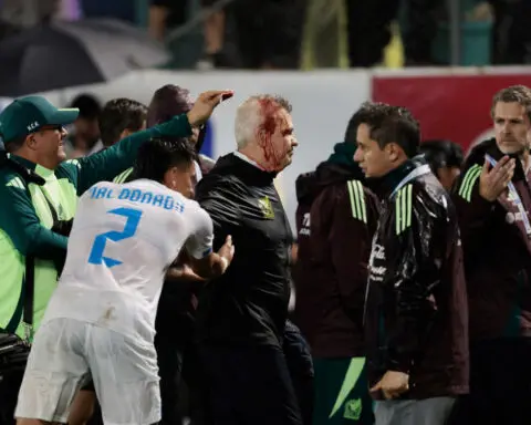 Mexico soccer manager Javier Aguirre struck by can thrown onto the pitch from stands, left with bloodied head