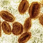 US health officials report 1st case of new form of mpox in a traveler