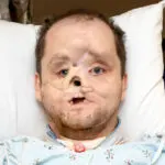 'I look like a person again': Michigan man shares story after face transplant