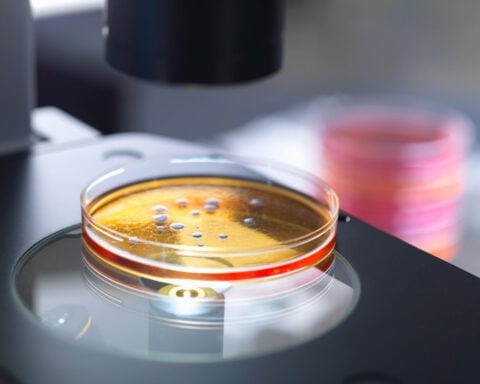 Scientists warn of ‘unprecedented’ risks of research into mirror life