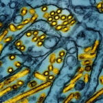 Virus in Louisiana bird flu patient shows mutations that could increase transmissibility to humans, CDC analysis finds