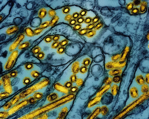 Virus in Louisiana bird flu patient shows mutations that could increase transmissibility to humans, CDC analysis finds