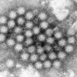 Nasty norovirus is back in full force with US cases of the stomach virus surging