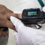 Pulse oximeters may misread oxygen levels in people of color. The FDA wants to change that