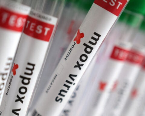 France identifies first case of new mpox variant, AFP reports