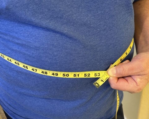 Obesity won't be solely defined by BMI under new plan for diagnosis by global experts