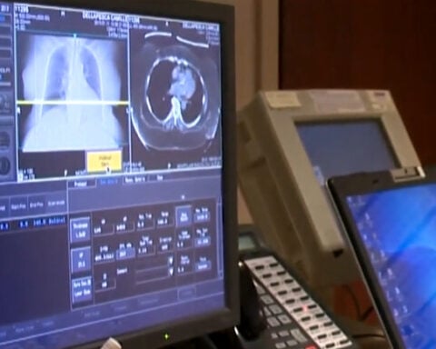 Hospital offers one-visit procedure to treat lung cancer