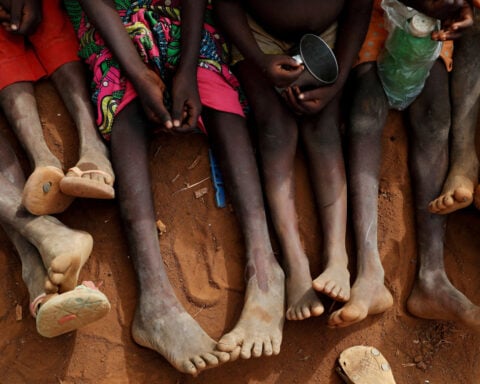 For millions of children in food crises, a heightened risk of lifelong damage
