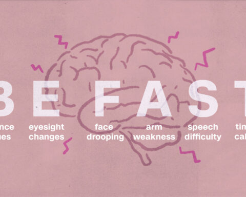 How to recognize signs of a stroke with the acronym BE FAST